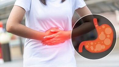 nutritional rules for stomach ulcers